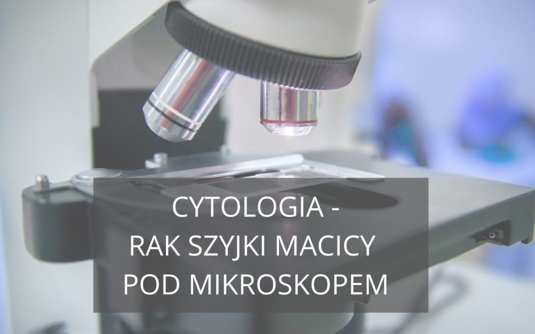 Cytologia – rak szyjki macicy pod mikroskopem