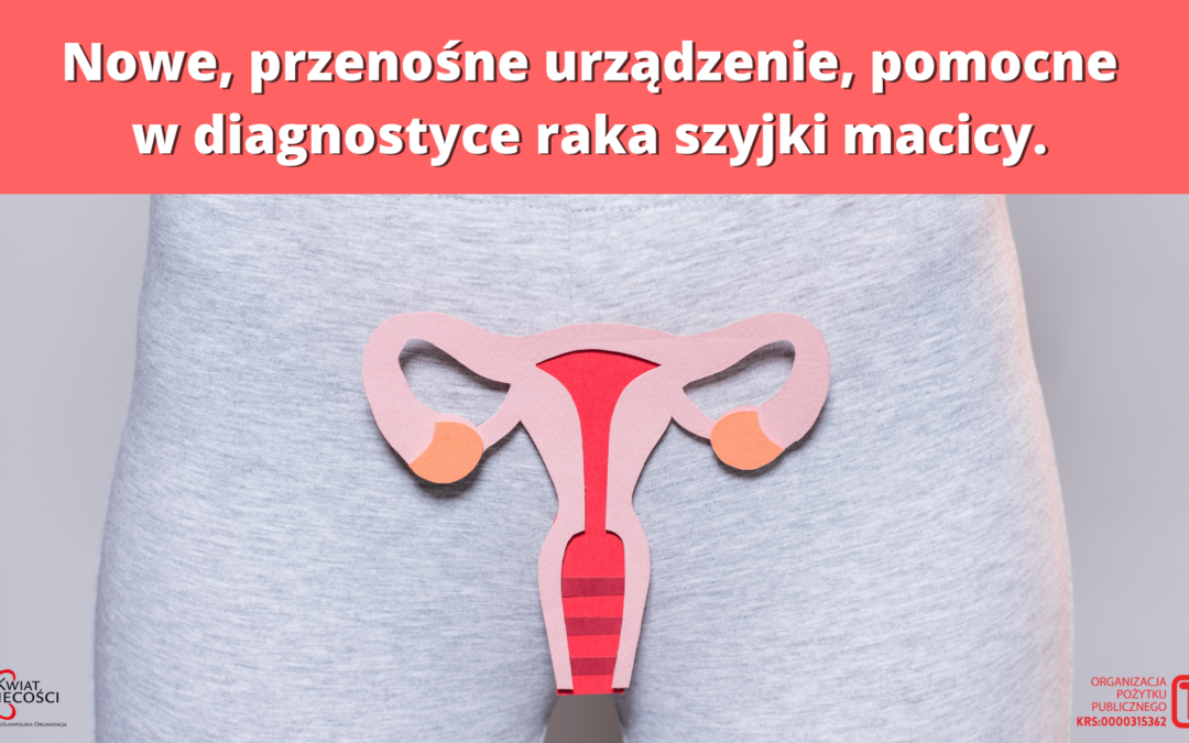 Eva Visual Check – nowe, przenośne urządzenie, pomocne w diagnostyce raka szyjki macicy – wywiad z dr Maciejem Mazurcem.